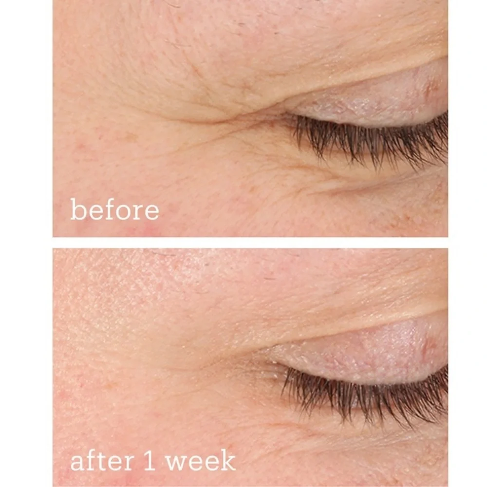 🌿 Skinfix Barrier+ Triple Lipid-Boost 360° Brightening Eye Cream